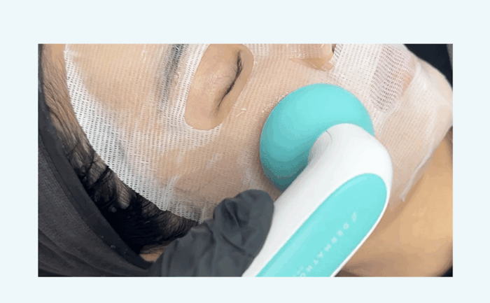 DERMATHOD Twin Cooler – Bild 2
